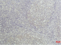 TNF alpha antibody [Q34]