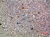 IL20 antibody