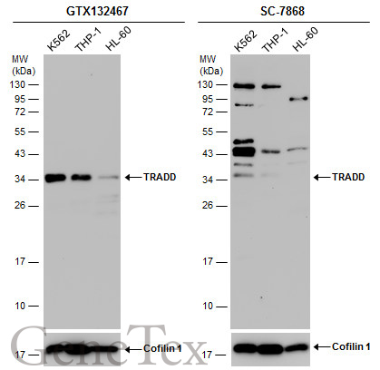 TRADD antibody