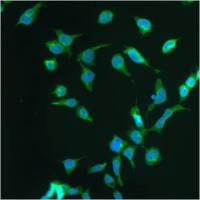 Progestin Receptor beta antibody