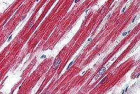 Leptin Receptor antibody, Internal