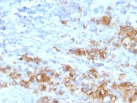 CA19-9 antibody [CA19.9/1390R]