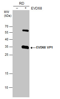Enterovirus D68 VP1 antibody