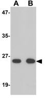 ZNF346 antibody