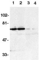 DR6 antibody