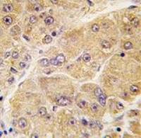 Sclerostin antibody, Internal