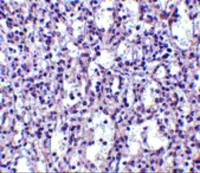 Carabin antibody