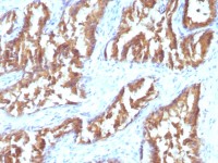 IDH1 antibody [IDH1/1152]