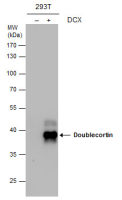 Doublecortin antibody [N1C2]
