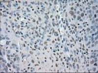 BUB1B antibody [11G2]