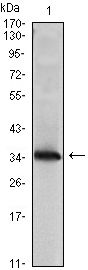 nm23-H1 antibody [4B2]