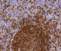 OneStep Polymer HRP anti-rat (Ready-to-Use)