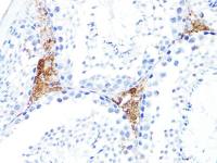 S100A10 antibody