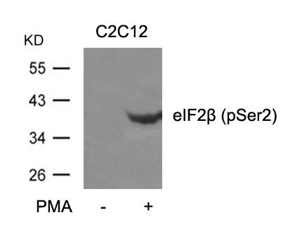 eIF2 beta (phospho Ser2) antibody