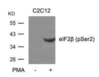 eIF2 beta (phospho Ser2) antibody