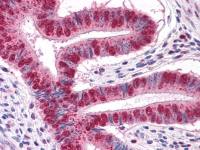 EXPAND1 / MUM1 antibody [4G10]