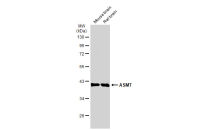 ASMT antibody
