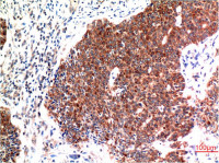 Beclin 1 antibody [5C2]