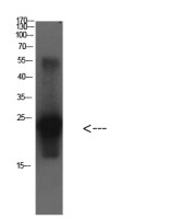 Cystatin C antibody [3B12]