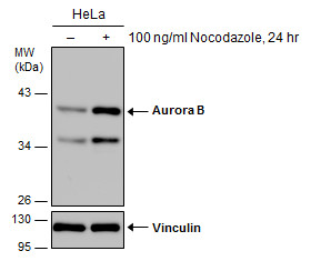 Aurora B antibody