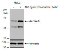 Aurora B antibody