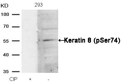 Cytokeratin 8 (phospho Ser74) antibody