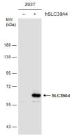 SLC39A4 antibody