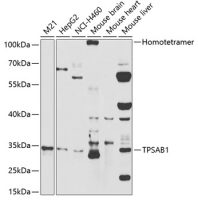 Mast cell tryptase antibody
