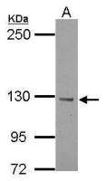 BTBD7 antibody [N1N2], N-term