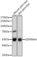 Kallistatin antibody