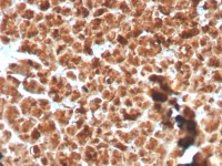 GP2 antibody [GP2/3134R]