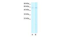 AChR alpha 2 antibody, N-term