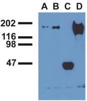 EGFR (phospho Tyr992) antibody [EM-12]