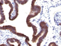 EpCAM antibody [EGP40/1120]