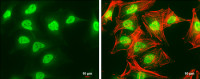 SET antibody, isoform 2-specific