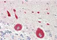 STYK1 antibody