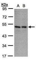 KIR3DL1 antibody