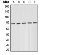 PKC delta (phospho Tyr52) antibody