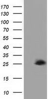 AK3 antibody [4C4]