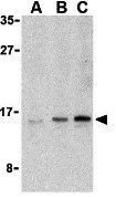 UEV1A antibody