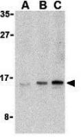 UEV1A antibody