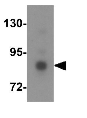 DYRK1A antibody