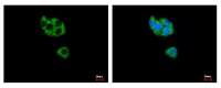 GCDH antibody