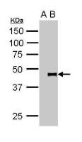Pygopus 2 antibody