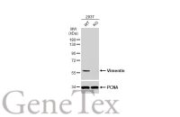 Vimentin antibody