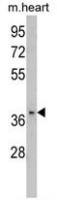 FBP2 antibody, C-term