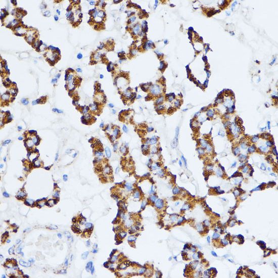 Monoamine Oxidase A antibody