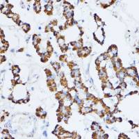 Monoamine Oxidase A antibody