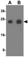Connexin 26 antibody