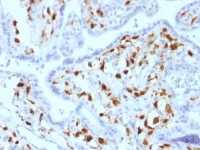 Factor XIIIa antibody [SPM180]
